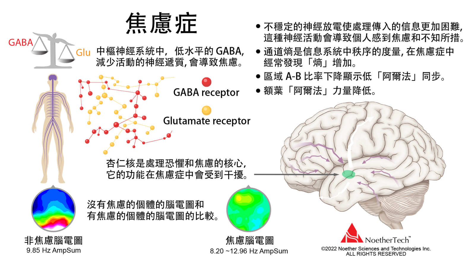 焦慮症_焦慮症腦電圖比較