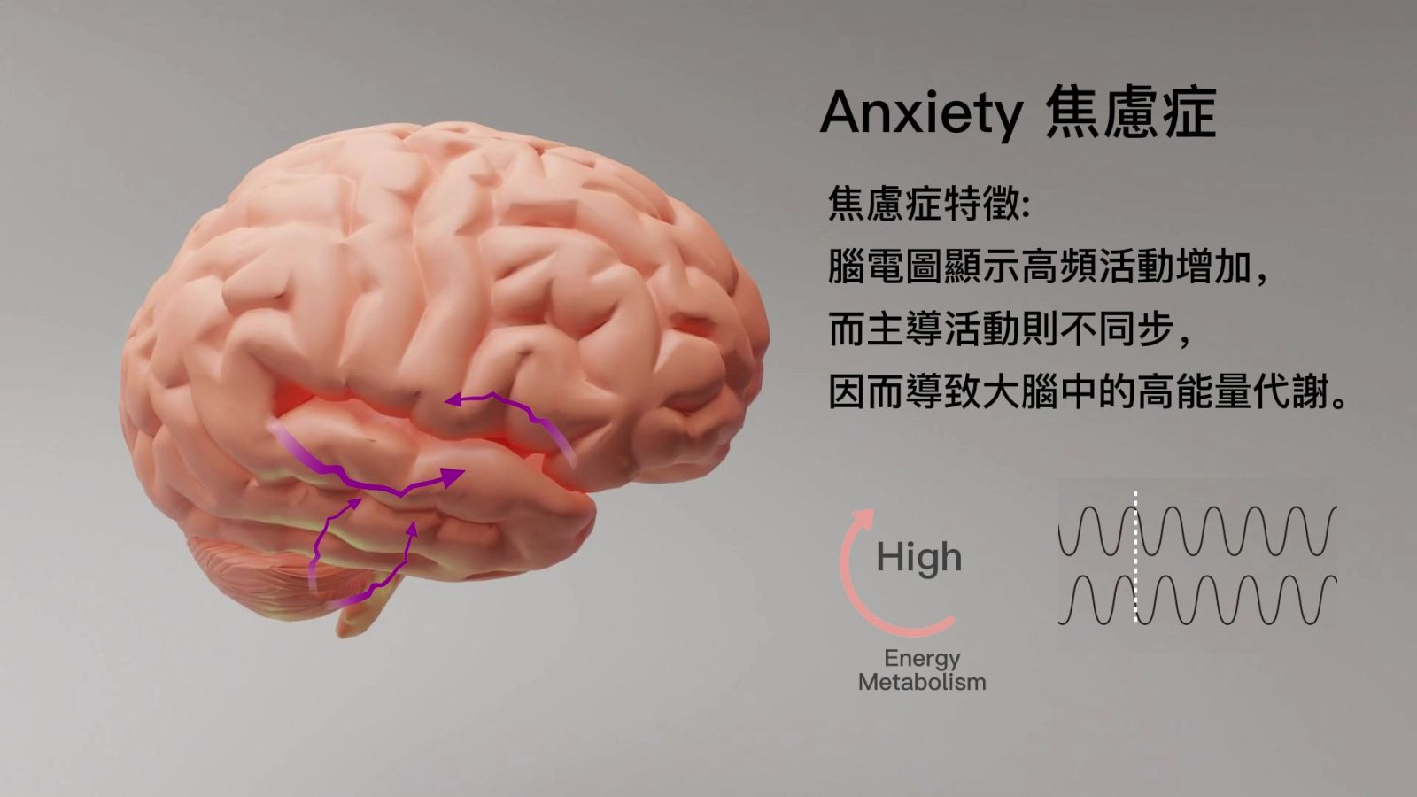 焦慮症特徵_3D圖