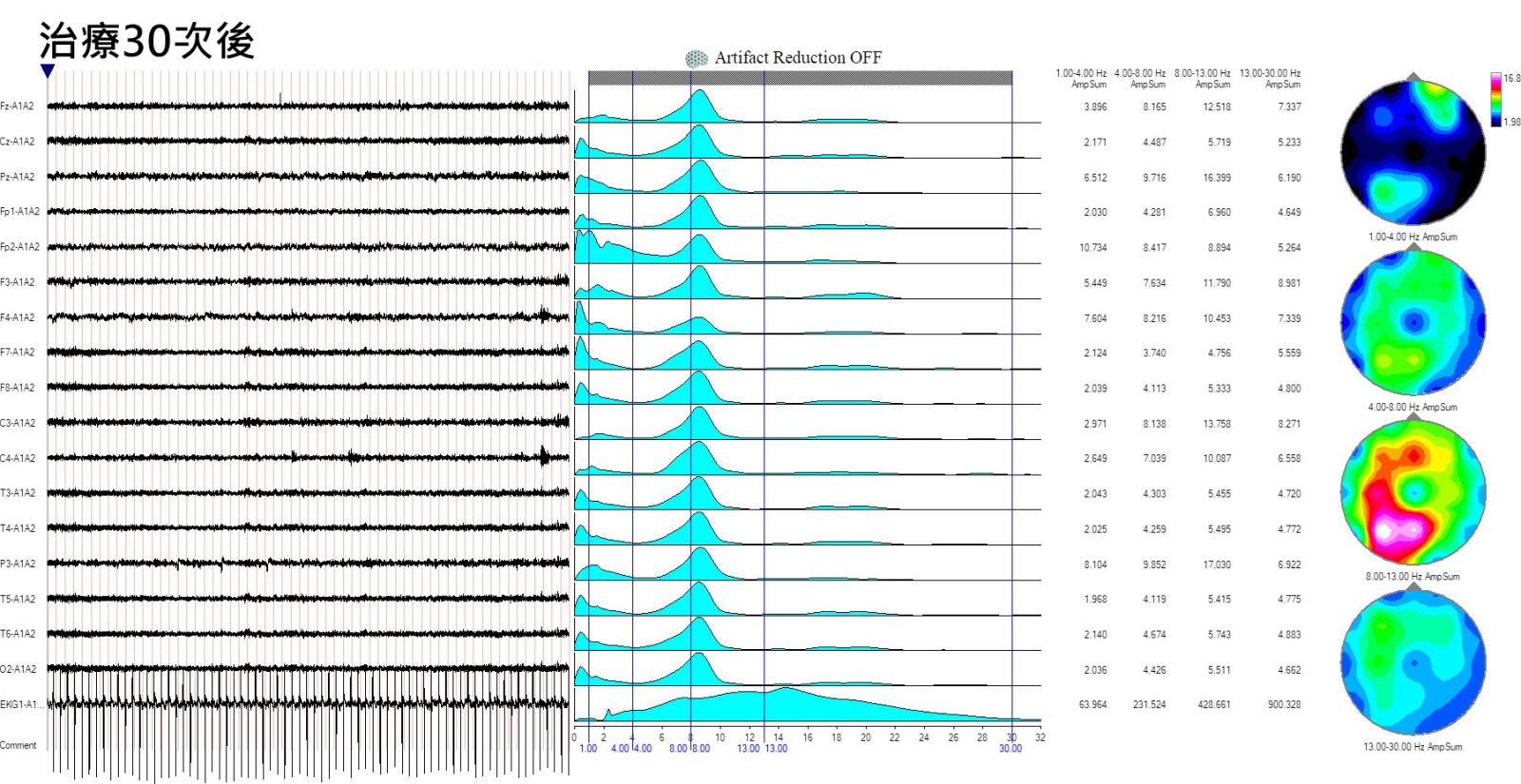 經過30次的療程